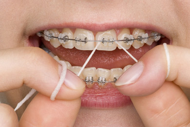 Professionelle Zahnreinigung - für Ihre Zahngesundheit